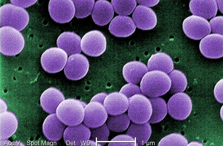 アレルギーと抗生物質について-マイクロバイオームの観点から